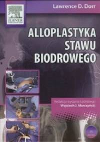 Alloplastyka stawu biodrowego - Lawrence D. Dorr