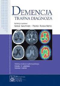 Demencja. Trafna diagnoza