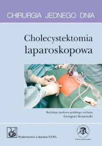 Cholecystektomia laparoskopowa. Chirurgia jednego dnia