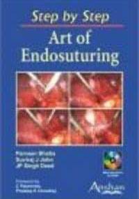 Art of Endosuturing