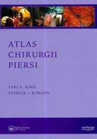 Tari A. King, Patrick I. Borgen. Atlas chirurgii piersi. - Tari A. King, Patrick I. Borgen