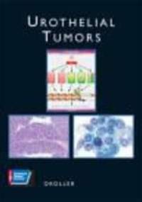 Urothelial Tumors - M. Droller