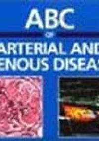 ABC of Arterial & Venous Disease CD ROM Slide - R. Donnelly
