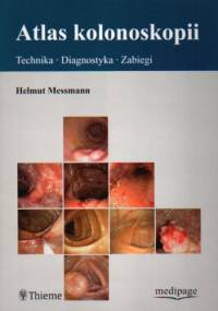 Atlas kolonoskopii - Helmut Messmann