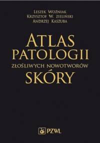 Atlas patologii złośliwych nowotworów skóry