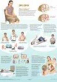 Epilepsy Chart - F. Netter