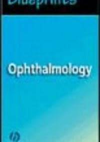 Blueprints Ophthalmology - Thomas E. Bournias