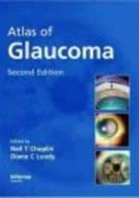 Atlas of Glaucoma - Diane C. Lundy, Neil T. Choplin