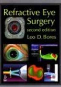 Refractive Eye Surgery - L. Bores