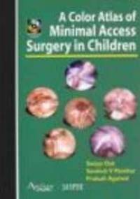Color Atlas of Minimal Access Surgery in Children