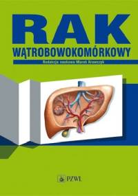 Rak wątrobowokomórkowy
