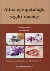Atlas cytopatologii szyjki macicy