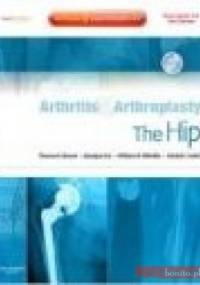 Arthritis and Arthroplasty The Hip with DVD