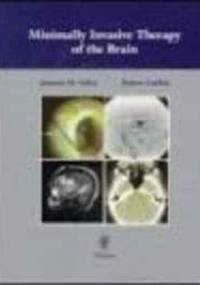 Minimally Invasive Therapy of Brain - Robert Lufkin