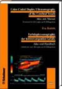 Color-Coded Duplex Sonography of Cerebral Vessels - Bartels