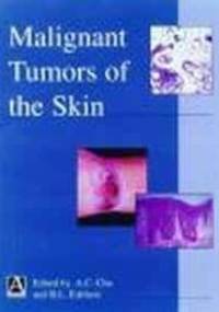 Malignant Tumors of Skin - A. Chu