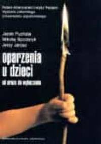 Oparzenia u dzieci. Od urazu do wyleczenia