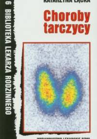 Choroby tarczycy - Katarzyna Łącka