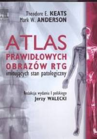 Atlas prawidłowych obrazów RTG imitujących stan patologiczny - Theodore E. Keats, Mark W. Anderson