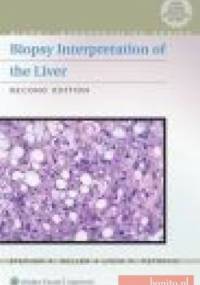 Biopsy Interpretation of the Liver - S. Geller