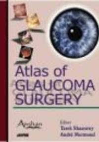 Atlas of Glaucoma Surgery - Tarek Shaarawy, Andre Mermoud