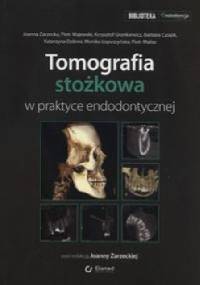 Tomografia stożkowa w praktyce endodontycznej - Joanna Zarzecka