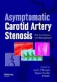 Asymptomatic Carotid Artery Stenosis