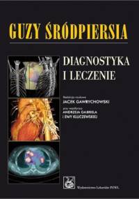 Guzy śródpiersia. Diagnostyka i leczenie